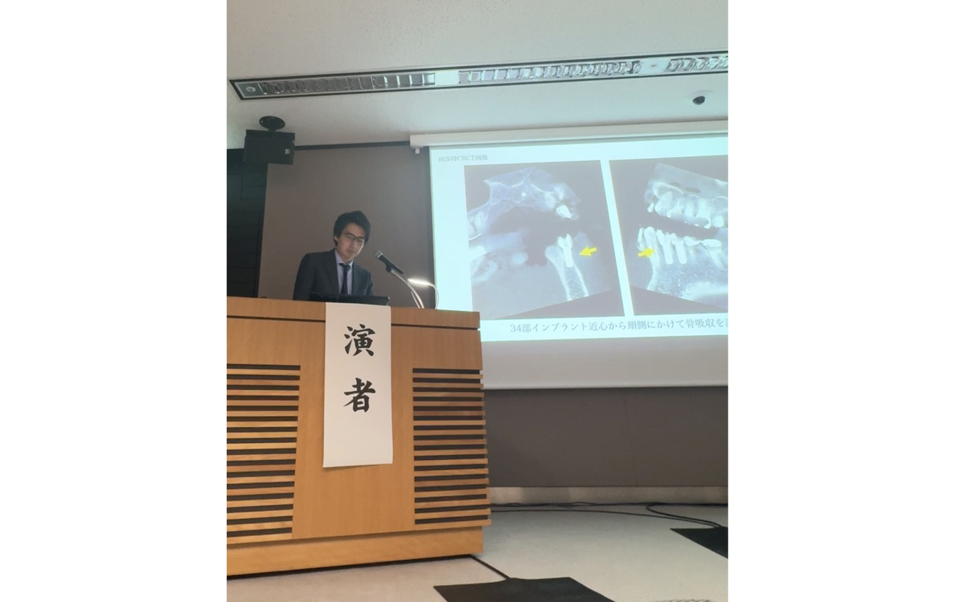 インプラント学会の年次大会でインプラント周囲炎の再生治療について発表しました｜戸越なかやま歯科