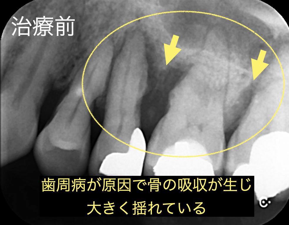 初診時