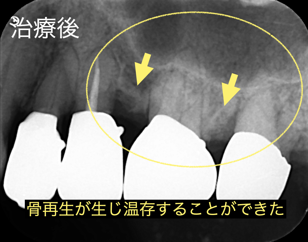 メインテナンス時
